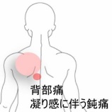 『肩甲骨周辺の重だるさと鈍痛で集中力が低下　登別室蘭すのさき鍼灸整骨院　症例報告』の画像