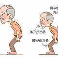 【膝の痛みに悩む方へ】膝だけじゃない？変形性膝関節症の原因と「姿勢」から変えるリハビリ