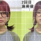 大雪が原因の、お顔のむくみやゆがみ気になってませんか？作楽整体院の小顔施術でケアして寒い冬を乗り切ってくださいね♪