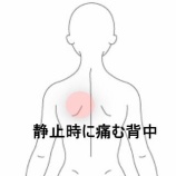 『感染症後の長期臥床で生じた左背部の静止時痛　登別室蘭すのさき鍼灸整骨院　症例報告　』の画像