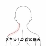 『首を動かすとズキッと痛む、デスクワーク姿勢による左後頚部痛 登別室蘭すのさき鍼灸整骨院 症例報告』の画像