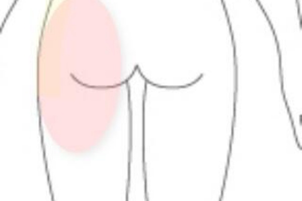 すのさき鍼灸整骨院 副院長のブログ 股関節の痛み