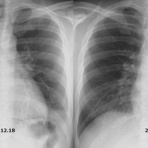 こどもの病気・おとなの病気