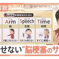 治療は「早期発見がカギ」 “夏の脳梗塞”は熱中症とそっくり?見逃せない“サイン”とは?【Nスタ解説】