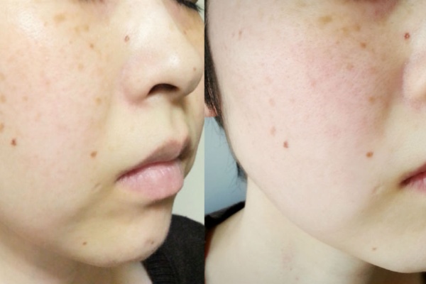 Facial Fitness Pao フェイシャルフィットネス パオ を使ってみた 第3回目レポ のんびりかめ子の休日